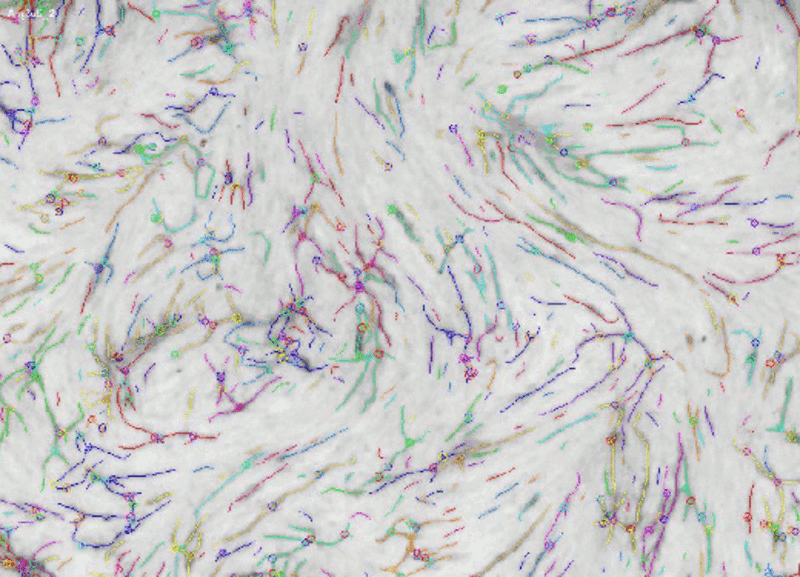 Angiogenesis